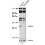 Western Blot - Anti-Rab2 Antibody (A307093) - Antibodies.com