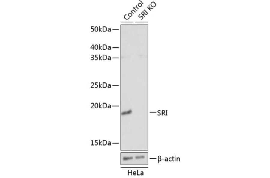 Western Blot - Anti-SR1 Antibody (A307094) - Antibodies.com