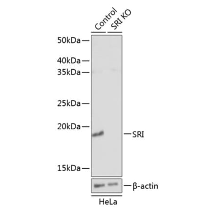 Western Blot - Anti-SR1 Antibody (A307094) - Antibodies.com