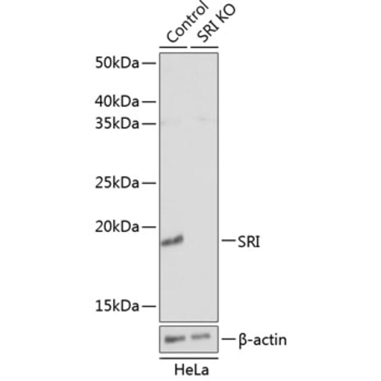 Western Blot - Anti-SR1 Antibody (A307094) - Antibodies.com