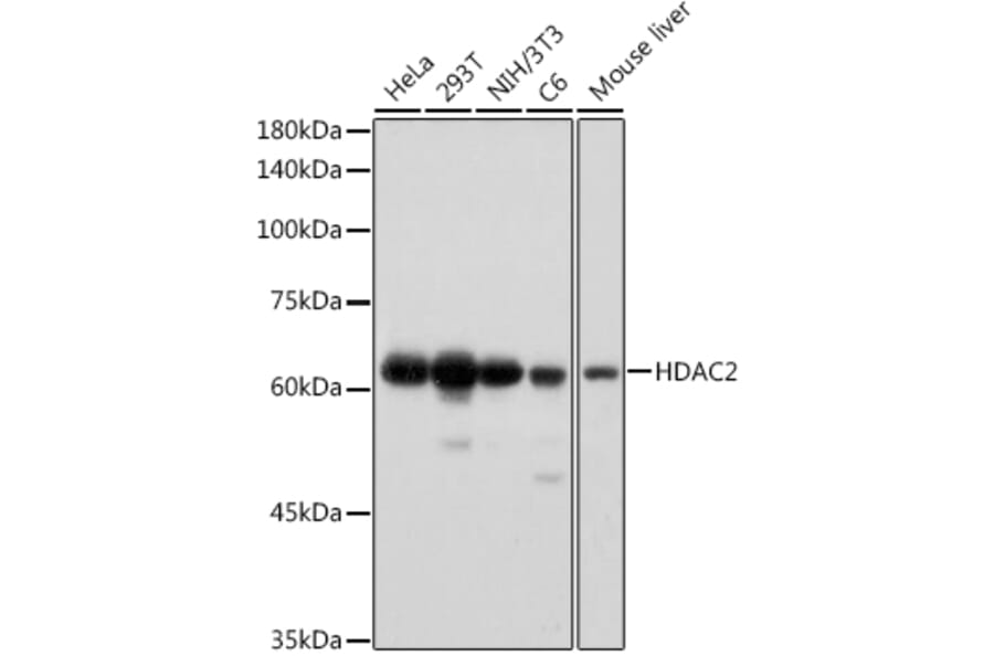 Western Blot - Anti-HDAC2 Antibody [ARC2647] (A307095) - Antibodies.com