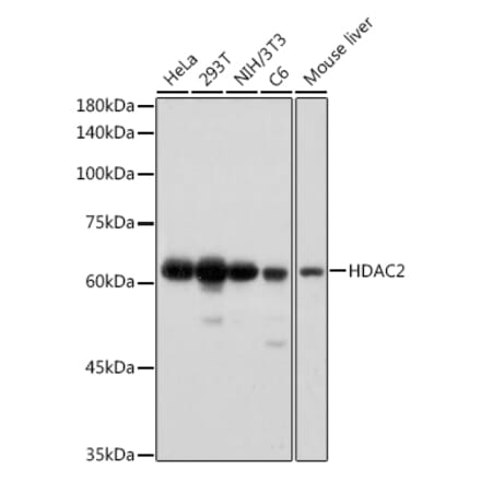 Western Blot - Anti-HDAC2 Antibody [ARC2647] (A307095) - Antibodies.com