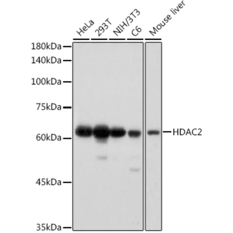 Western Blot - Anti-HDAC2 Antibody [ARC2647] (A307095) - Antibodies.com