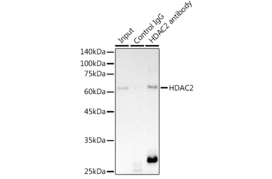 Western Blot - Anti-HDAC2 Antibody [ARC2647] (A307095) - Antibodies.com