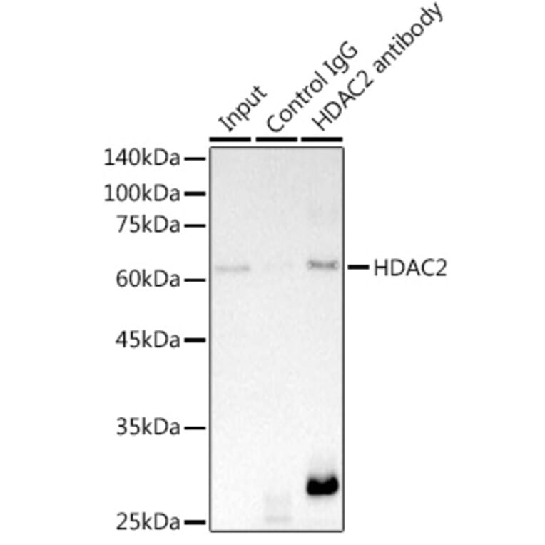 Western Blot - Anti-HDAC2 Antibody [ARC2647] (A307095) - Antibodies.com