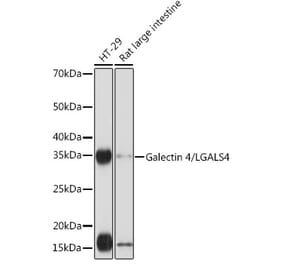 Western Blot - Anti-GAL4 Antibody [ARC2073] (A307096) - Antibodies.com
