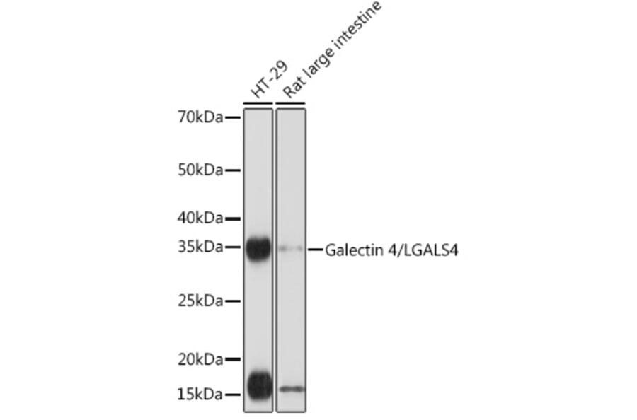 Western Blot - Anti-GAL4 Antibody [ARC2073] (A307096) - Antibodies.com