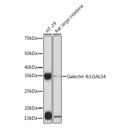 Western Blot - Anti-GAL4 Antibody [ARC2073] (A307096) - Antibodies.com