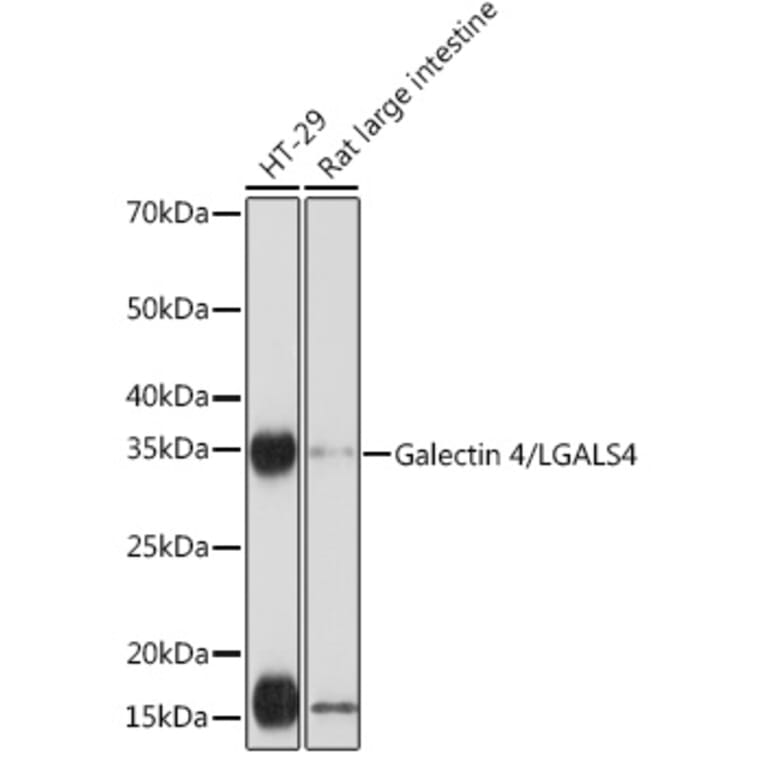 Western Blot - Anti-GAL4 Antibody [ARC2073] (A307096) - Antibodies.com