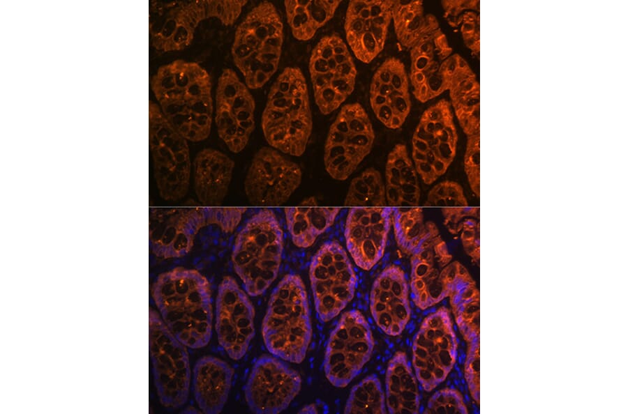 Immunofluorescence - Anti-GAL4 Antibody [ARC2073] (A307096) - Antibodies.com