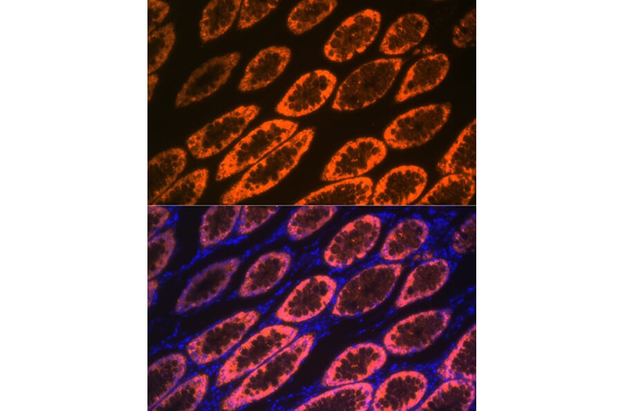 Immunofluorescence - Anti-GAL4 Antibody [ARC2073] (A307096) - Antibodies.com
