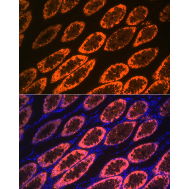 Immunofluorescence - Anti-GAL4 Antibody [ARC2073] (A307096) - Antibodies.com