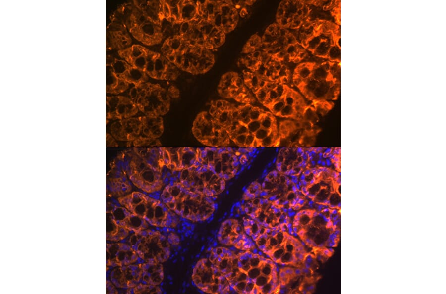 Immunofluorescence - Anti-GAL4 Antibody [ARC2073] (A307096) - Antibodies.com