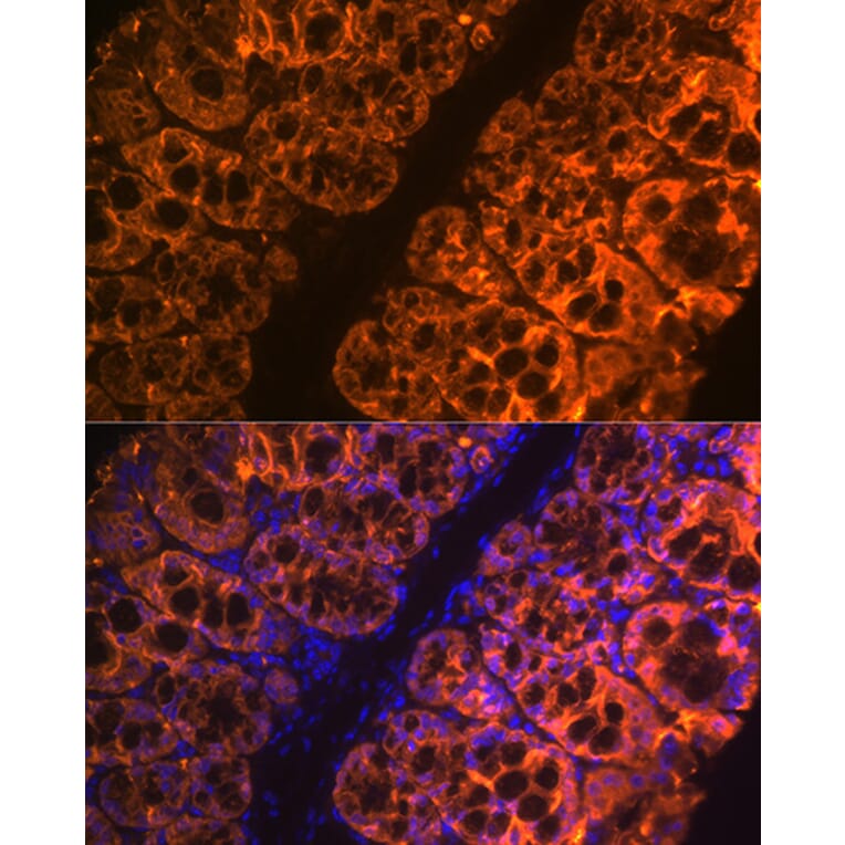 Immunofluorescence - Anti-GAL4 Antibody [ARC2073] (A307096) - Antibodies.com