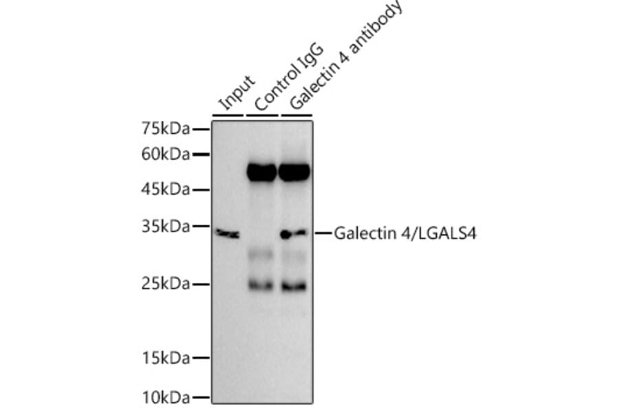 Western Blot - Anti-GAL4 Antibody [ARC2073] (A307096) - Antibodies.com