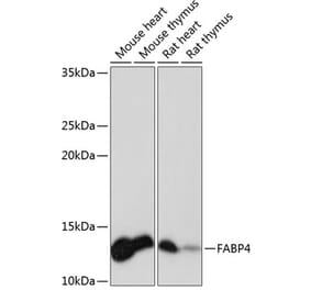 Western Blot - Anti-FABP4 Antibody [ARC0616] (A307097) - Antibodies.com
