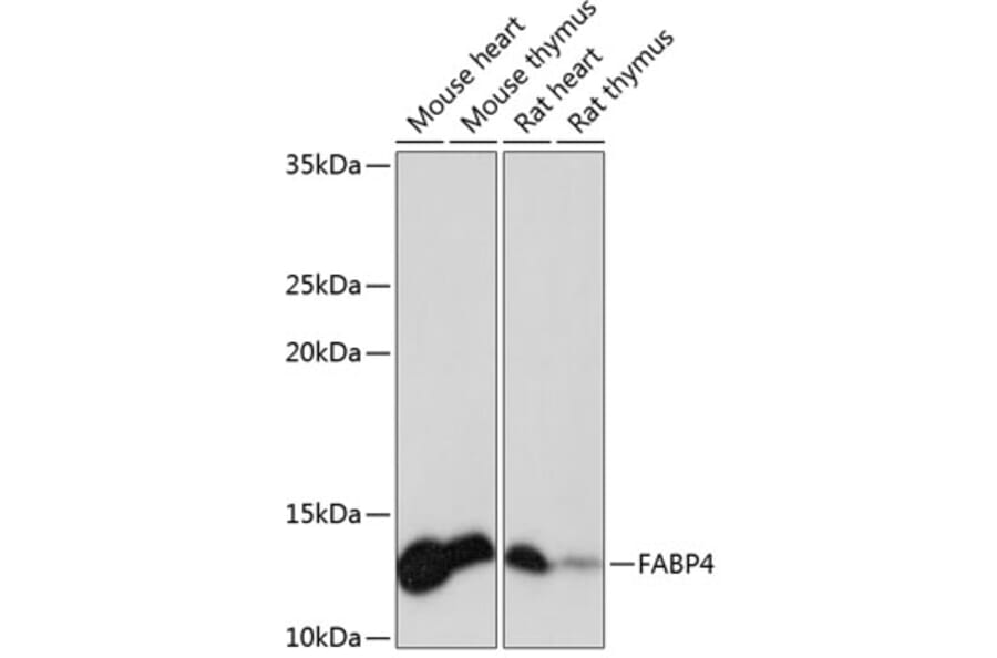 Western Blot - Anti-FABP4 Antibody [ARC0616] (A307097) - Antibodies.com