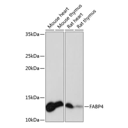 Western Blot - Anti-FABP4 Antibody [ARC0616] (A307097) - Antibodies.com