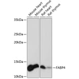 Western Blot - Anti-FABP4 Antibody [ARC0616] (A307097) - Antibodies.com