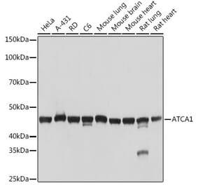 Western Blot - Anti-muscle Actin Antibody [ARC1913] (A307098) - Antibodies.com