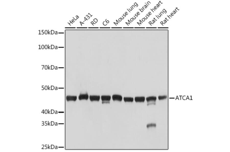 Western Blot - Anti-muscle Actin Antibody [ARC1913] (A307098) - Antibodies.com