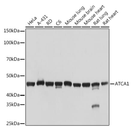 Western Blot - Anti-muscle Actin Antibody [ARC1913] (A307098) - Antibodies.com