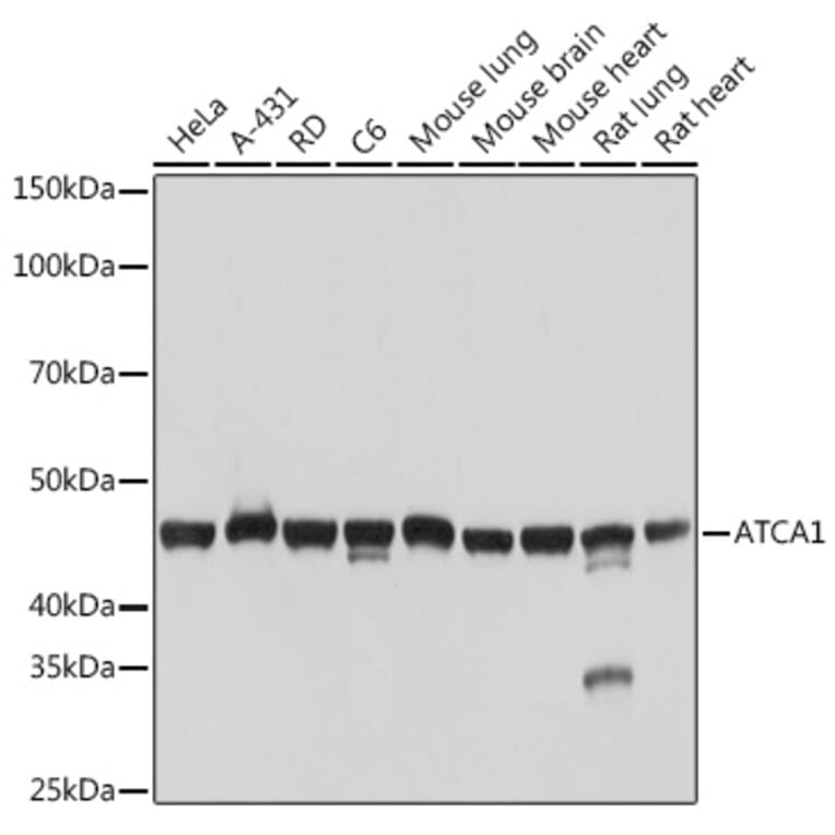 Western Blot - Anti-muscle Actin Antibody [ARC1913] (A307098) - Antibodies.com