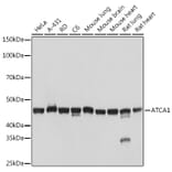 Western Blot - Anti-muscle Actin Antibody [ARC1913] (A307098) - Antibodies.com