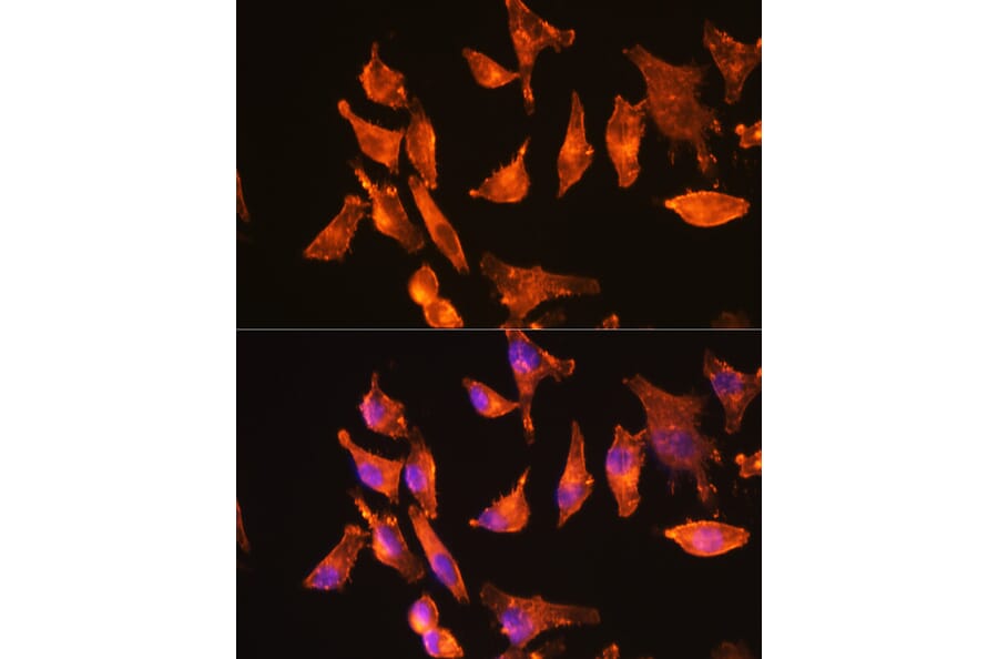 Immunofluorescence - Anti-muscle Actin Antibody [ARC1913] (A307098) - Antibodies.com