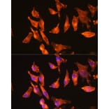 Immunofluorescence - Anti-muscle Actin Antibody [ARC1913] (A307098) - Antibodies.com