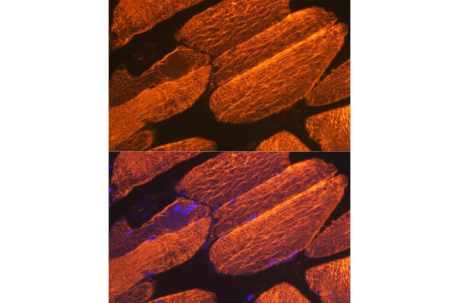 Immunofluorescence - Anti-muscle Actin Antibody [ARC1913] (A307098) - Antibodies.com