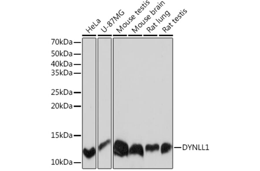 Western Blot - Anti-DYNLL1/PIN Antibody [ARC0975] (A307099) - Antibodies.com