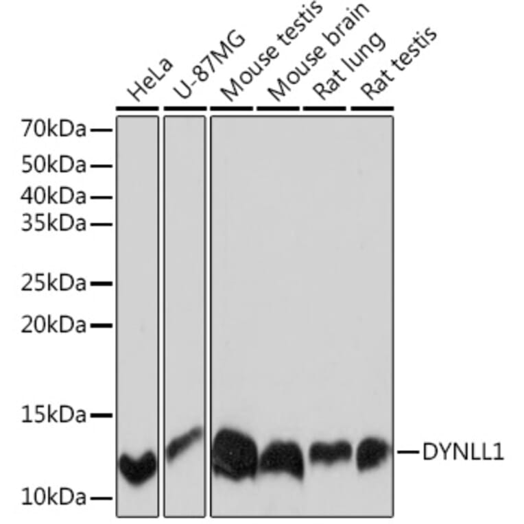 Western Blot - Anti-DYNLL1/PIN Antibody [ARC0975] (A307099) - Antibodies.com