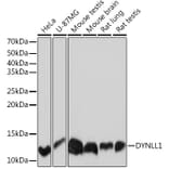 Western Blot - Anti-DYNLL1/PIN Antibody [ARC0975] (A307099) - Antibodies.com