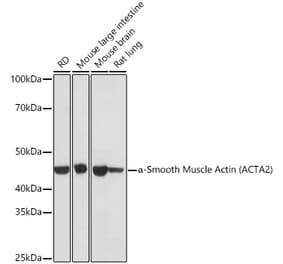 Western Blot - Anti-alpha smooth muscle Actin Antibody [ARC0298] (A307100) - Antibodies.com