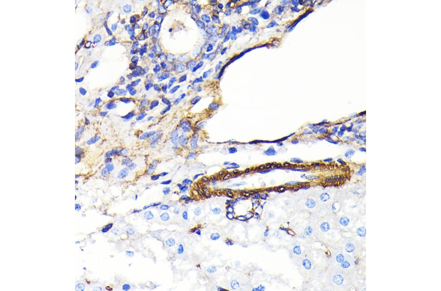 Immunohistochemistry - Anti-alpha smooth muscle Actin Antibody [ARC0298] (A307100) - Antibodies.com
