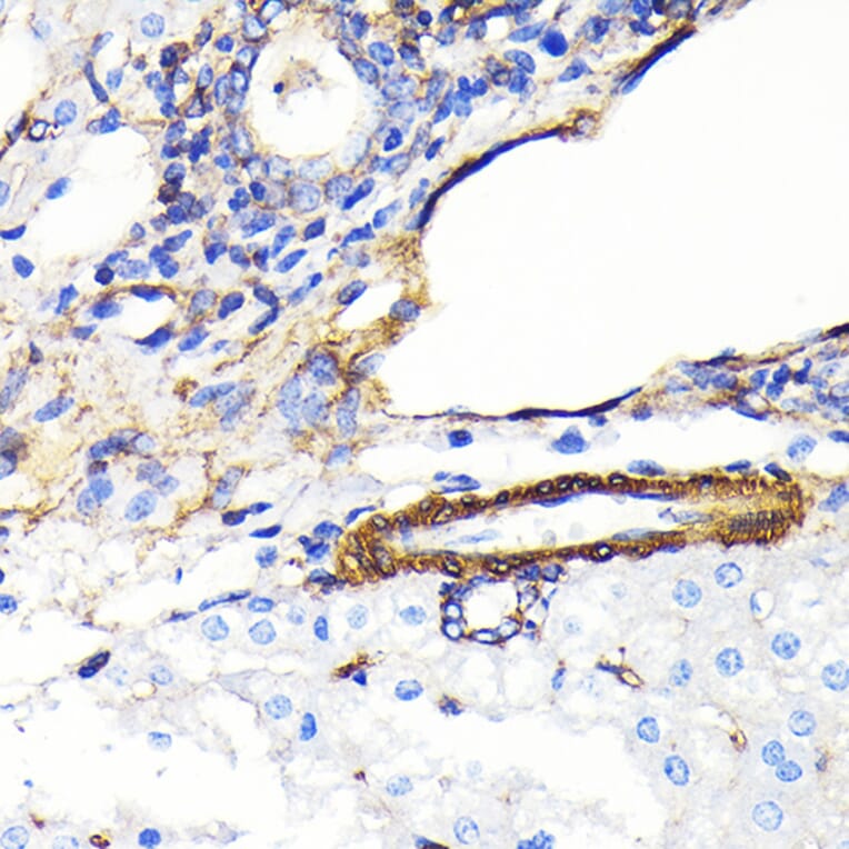 Immunohistochemistry - Anti-alpha smooth muscle Actin Antibody [ARC0298] (A307100) - Antibodies.com
