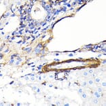 Immunohistochemistry - Anti-alpha smooth muscle Actin Antibody [ARC0298] (A307100) - Antibodies.com