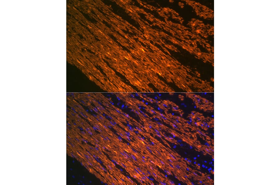 Immunofluorescence - Anti-alpha smooth muscle Actin Antibody [ARC0298] (A307100) - Antibodies.com