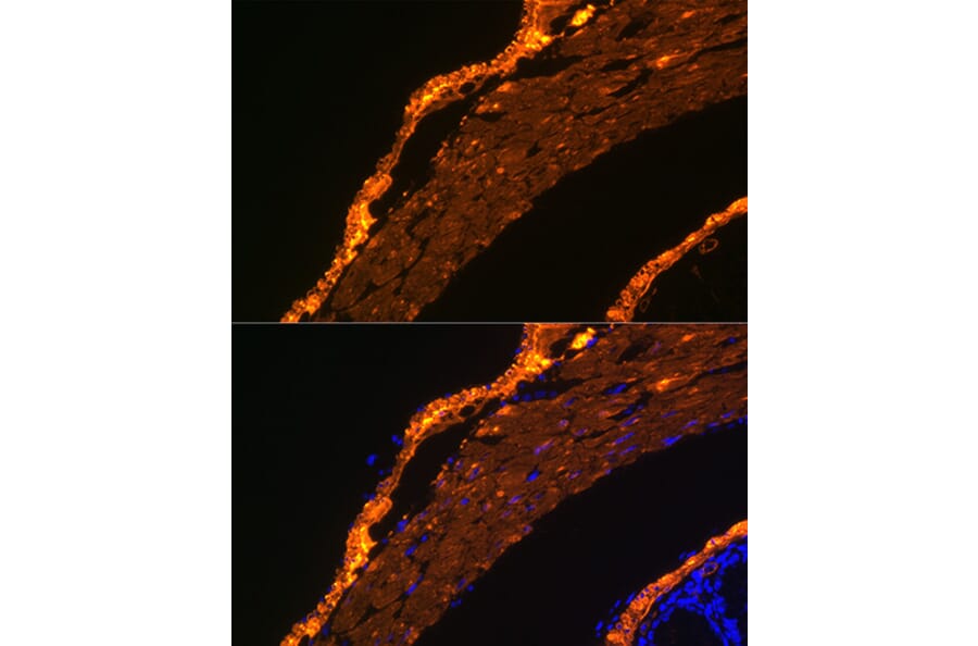 Immunofluorescence - Anti-alpha smooth muscle Actin Antibody [ARC0298] (A307100) - Antibodies.com