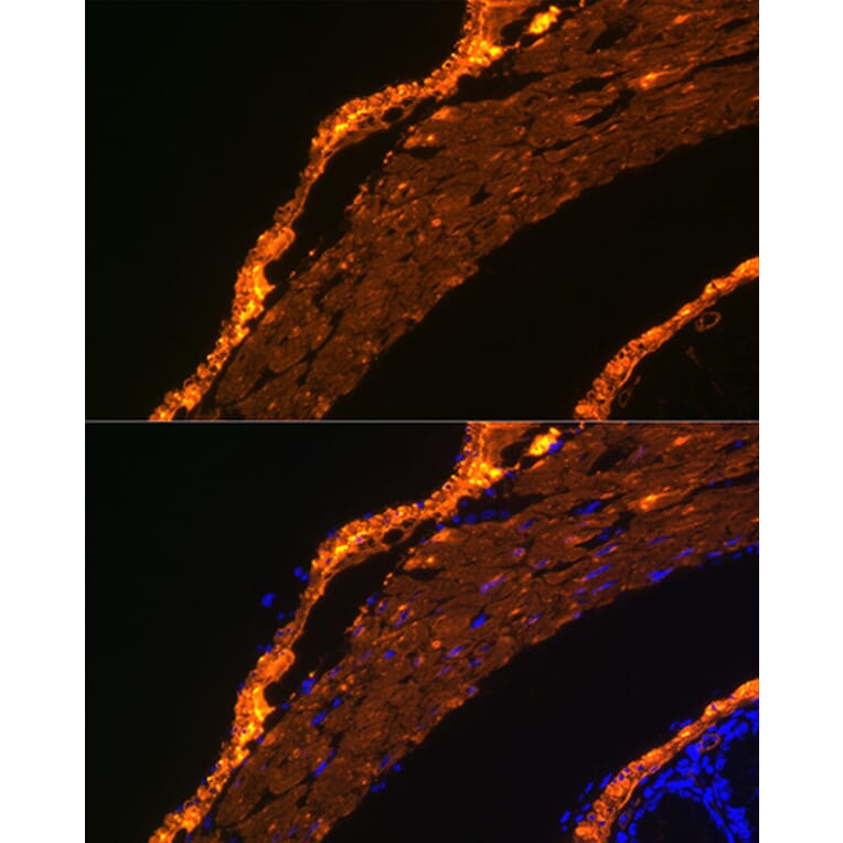 Immunofluorescence - Anti-alpha smooth muscle Actin Antibody [ARC0298] (A307100) - Antibodies.com
