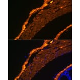 Immunofluorescence - Anti-alpha smooth muscle Actin Antibody [ARC0298] (A307100) - Antibodies.com