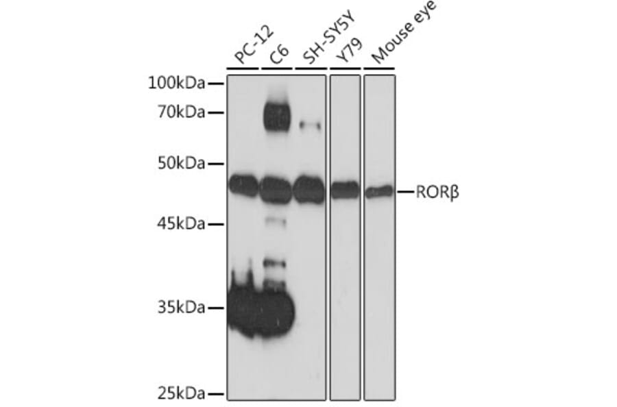 Western Blot - Anti-ROR beta/RORB Antibody [ARC2279] (A307101) - Antibodies.com
