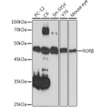 Western Blot - Anti-ROR beta/RORB Antibody [ARC2279] (A307101) - Antibodies.com