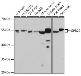 Western Blot - Anti-GPCR GPR22 Antibody (A307102) - Antibodies.com