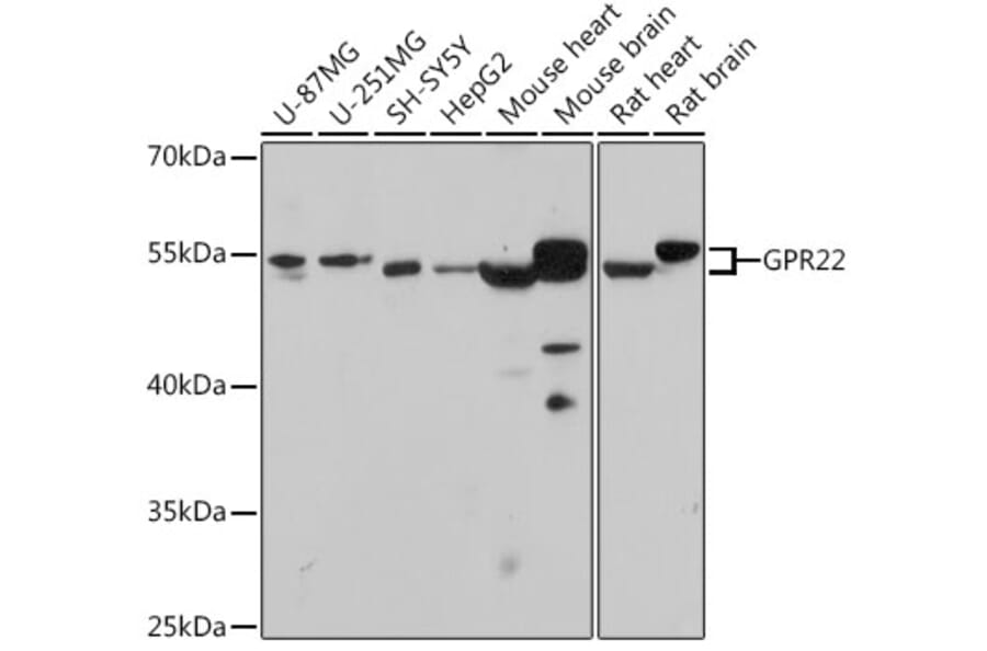 Western Blot - Anti-GPCR GPR22 Antibody (A307102) - Antibodies.com