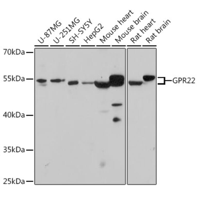 Western Blot - Anti-GPCR GPR22 Antibody (A307102) - Antibodies.com