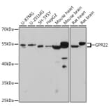 Western Blot - Anti-GPCR GPR22 Antibody (A307102) - Antibodies.com