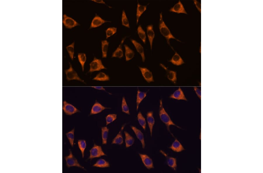 Immunofluorescence - Anti-GPCR GPR22 Antibody (A307102) - Antibodies.com