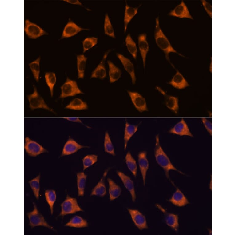 Immunofluorescence - Anti-GPCR GPR22 Antibody (A307102) - Antibodies.com